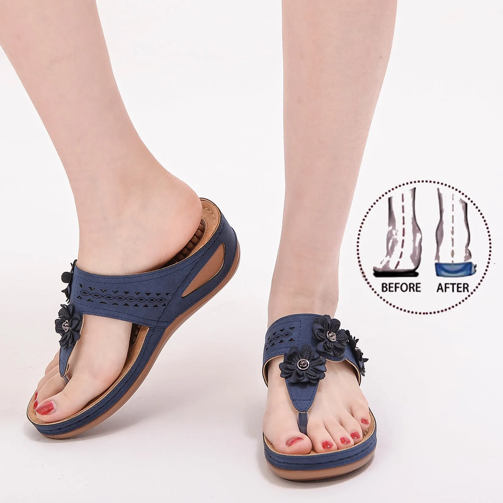 Summer Women's Massage Tablets Wear-resistant Non-slip Beef Tendon Thick-soled Slippers